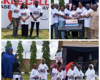 Late sickle cell diagnosis killing Nigerian children – Prof Nnodu