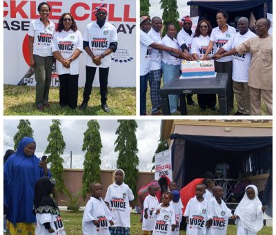 Late sickle cell diagnosis killing Nigerian children – Prof Nnodu